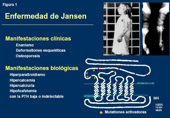 Jansen