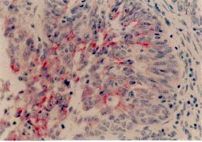 Inmunohistoqumica