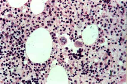 Myelolipoma, HE 400x