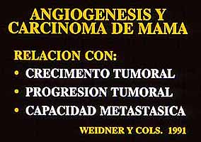 Fig. 20. ANGIOGENESIS EN CARCINOMA DE MAMA