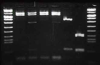 Fig. 43. DEMOSTRACION DE HPV POR RCP. HAY MAYOR SENSIBILIDAD.