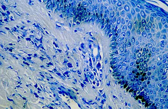 figura29.jpg (57631 bytes)
