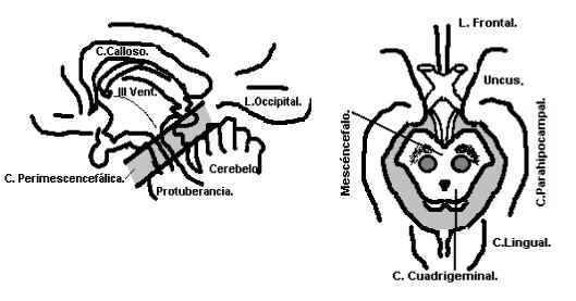 Proyeccin lateral e infero-superior