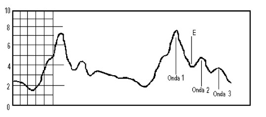 Ondas cardiacas de la PIC medidas a rpida velocidad