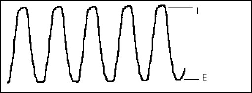 hipertensionendoc3.jpg (17750 bytes)