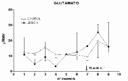 Glutamato