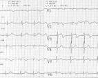 Pulse para ver una imagen ampliada (85 K)