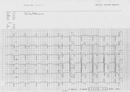 Pulse sobre el ECG para ver una imagen ampliada (84K)